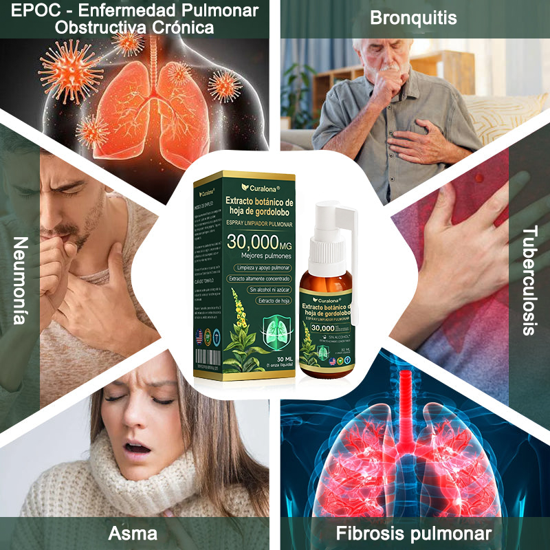 ✅ Tienda oficial insignia en EE. UU.: Spray limpiador pulmonar Curalona® con extracto de hoja de gordolobo (👨‍⚕️ Indicado para EPOC, asma, bronquitis crónica, infecciones respiratorias, cáncer de pulmón, sinusitis y otras afecciones pulmonares)