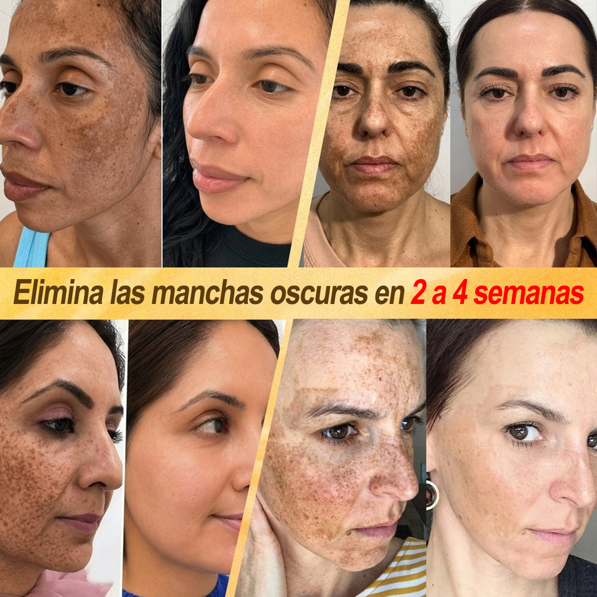 ✨🐝 Purelora® Crema de Reposición de Crema de Sol de Monocromo (Un solo producto para reposición) 𝐢𝐧𝐟𝐥𝐚𝐦𝐦𝐚𝐭𝐢𝐨𝐧, 𝐝𝐫𝐲𝐧𝐞𝐬𝐬, 𝐚𝐠𝐢𝐧𝐠, 𝐩𝐢𝐠𝐦𝐞𝐧𝐭𝐚𝐭𝐢𝐨𝐧, 𝐚𝐧𝐝 𝐯𝐢𝐬𝐢𝐛𝐥𝐞 𝐬𝐤𝐢𝐧 𝐝𝐚𝐦𝐚𝐠𝐞.)