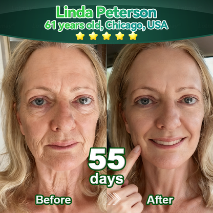 Purelora® Stem Cell–Derived EGF & Copper Peptide Activating Serum  (Deeply activates skin renewal from within for firmer, smoother-looking skin)