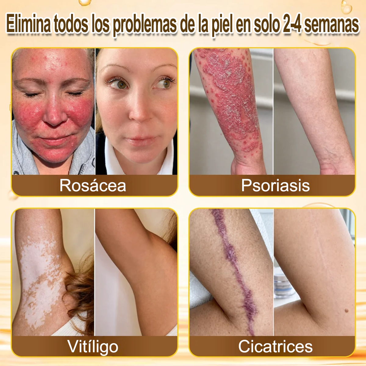 ✨🐝 Purelora® Crema de Reposición de Crema de Sol de Monocromo (Un solo producto para reposición) 𝐢𝐧𝐟𝐥𝐚𝐦𝐦𝐚𝐭𝐢𝐨𝐧, 𝐝𝐫𝐲𝐧𝐞𝐬𝐬, 𝐚𝐠𝐢𝐧𝐠, 𝐩𝐢𝐠𝐦𝐞𝐧𝐭𝐚𝐭𝐢𝐨𝐧, 𝐚𝐧𝐝 𝐯𝐢𝐬𝐢𝐛𝐥𝐞 𝐬𝐤𝐢𝐧 𝐝𝐚𝐦𝐚𝐠𝐞.)