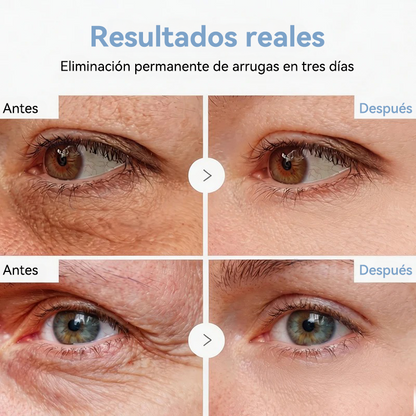 💎👨‍⚕️🌿𝐏𝐔𝐑𝐄𝐋𝐎𝐑𝐀® PDRN Anti-Wrinkle Shot – Crema reafirmante y con efecto lifting