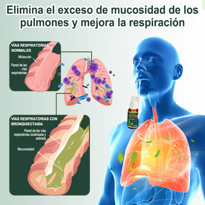 ✅ Tienda oficial insignia en EE. UU.: Spray limpiador pulmonar Curalona® con extracto de hoja de gordolobo (👨‍⚕️ Indicado para EPOC, asma, bronquitis crónica, infecciones respiratorias, cáncer de pulmón, sinusitis y otras afecciones pulmonares)