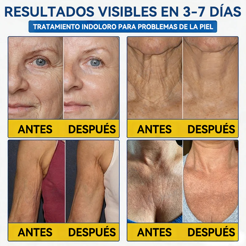 💎👨‍⚕️🌿𝐏𝐔𝐑𝐄𝐋𝐎𝐑𝐀® PDRN Anti-Wrinkle Shot – Crema reafirmante y con efecto lifting
