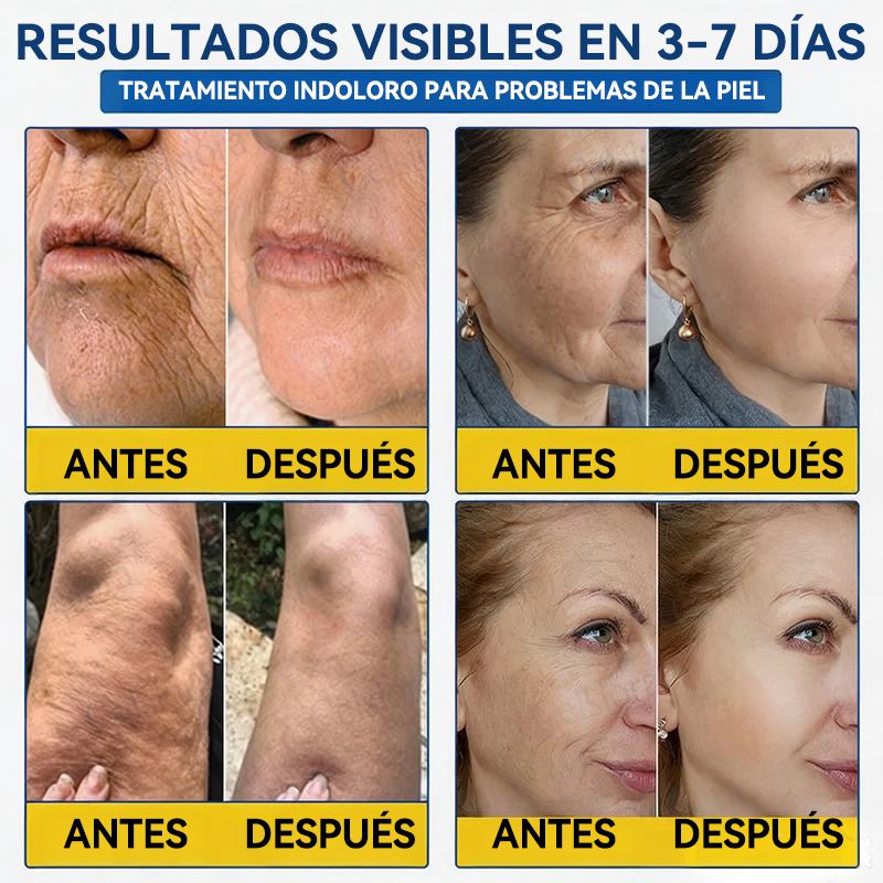 💎👨‍⚕️🌿𝐏𝐔𝐑𝐄𝐋𝐎𝐑𝐀® PDRN Anti-Wrinkle Shot – Crema reafirmante y con efecto lifting