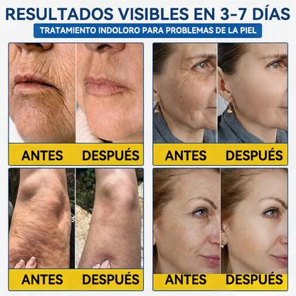 💎👨‍⚕️🌿𝐏𝐔𝐑𝐄𝐋𝐎𝐑𝐀® PDRN Anti-Wrinkle Shot – Crema reafirmante y con efecto lifting