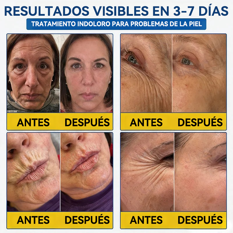 💎👨‍⚕️🌿𝐏𝐔𝐑𝐄𝐋𝐎𝐑𝐀® PDRN Anti-Wrinkle Shot – Crema reafirmante y con efecto lifting