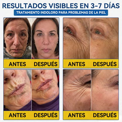 💎👨‍⚕️🌿𝐏𝐔𝐑𝐄𝐋𝐎𝐑𝐀® PDRN Anti-Wrinkle Shot – Crema reafirmante y con efecto lifting