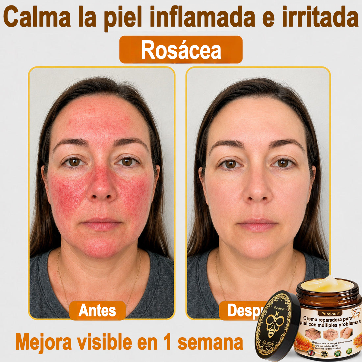 ✨🐝 Purelora® Crema de Reposición de Crema de Sol de Monocromo (Un solo producto para reposición) 𝐢𝐧𝐟𝐥𝐚𝐦𝐦𝐚𝐭𝐢𝐨𝐧, 𝐝𝐫𝐲𝐧𝐞𝐬𝐬, 𝐚𝐠𝐢𝐧𝐠, 𝐩𝐢𝐠𝐦𝐞𝐧𝐭𝐚𝐭𝐢𝐨𝐧, 𝐚𝐧𝐝 𝐯𝐢𝐬𝐢𝐛𝐥𝐞 𝐬𝐤𝐢𝐧 𝐝𝐚𝐦𝐚𝐠𝐞.)