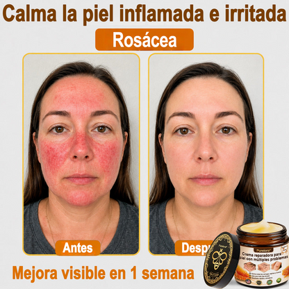 ✨🐝 Purelora® Crema de Reposición de Crema de Sol de Monocromo (Un solo producto para reposición) 𝐢𝐧𝐟𝐥𝐚𝐦𝐦𝐚𝐭𝐢𝐨𝐧, 𝐝𝐫𝐲𝐧𝐞𝐬𝐬, 𝐚𝐠𝐢𝐧𝐠, 𝐩𝐢𝐠𝐦𝐞𝐧𝐭𝐚𝐭𝐢𝐨𝐧, 𝐚𝐧𝐝 𝐯𝐢𝐬𝐢𝐛𝐥𝐞 𝐬𝐤𝐢𝐧 𝐝𝐚𝐦𝐚𝐠𝐞.)