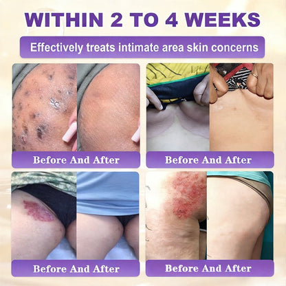 Fabricada y enviada desde EE. UU. 🍁 Crema reparadora de la piel Purelora® con biotina (fórmula 10 en 1) — Último día de oferta: 75 % de descuento.（副本）