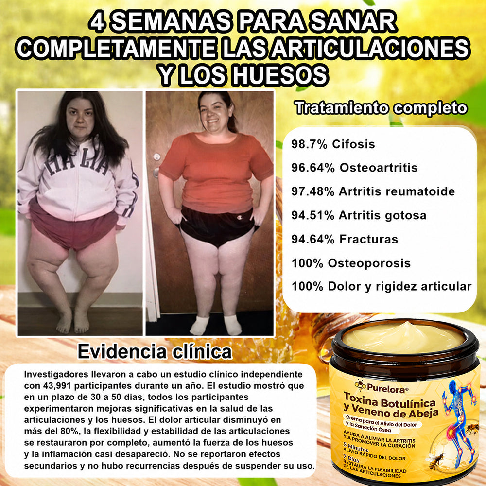 Crema Purelora® con toxina botulínica y veneno de abeja para el alivio del dolor y la regeneración ósea