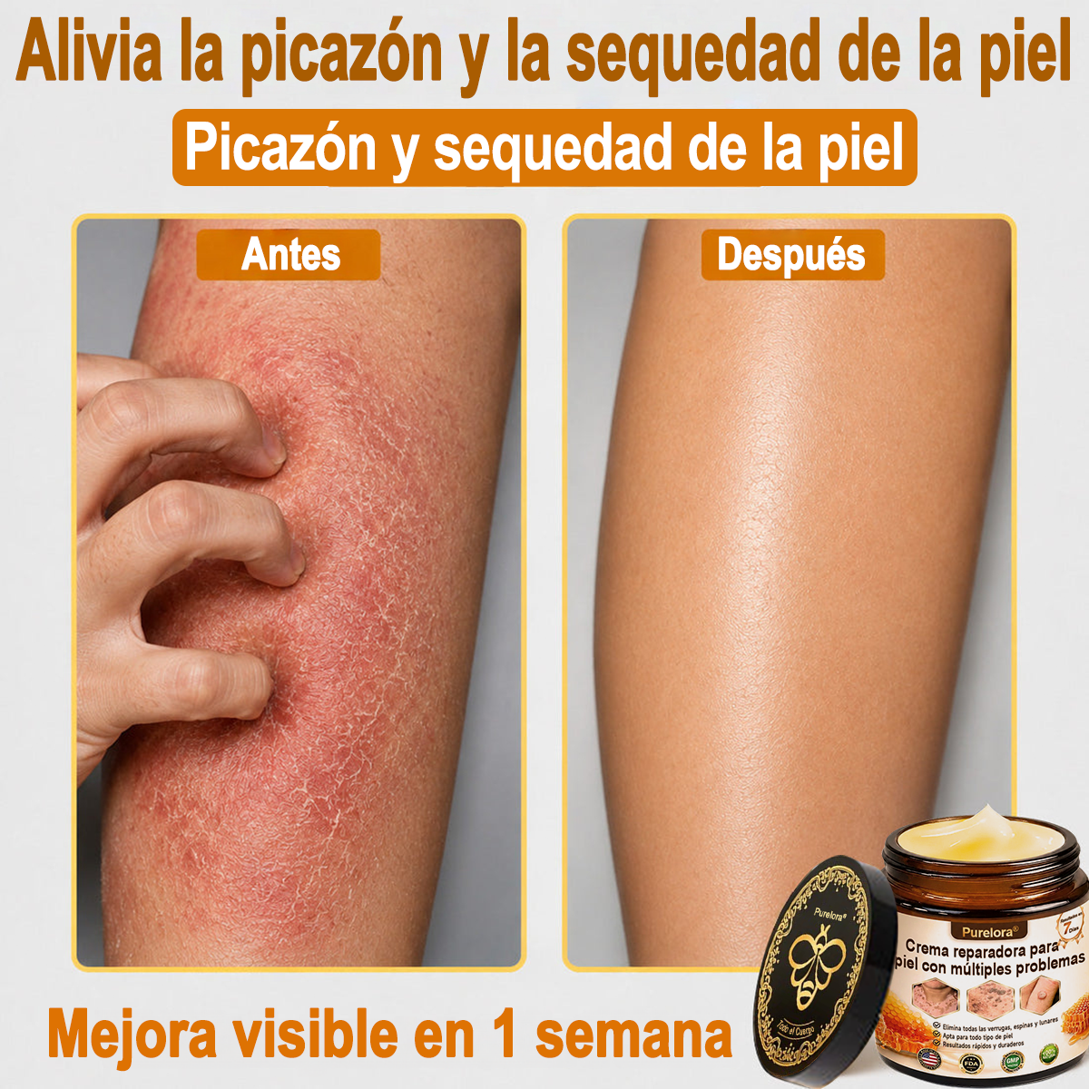 ✨🐝 Purelora® Crema de Reposición de Crema de Sol de Monocromo (Un solo producto para reposición) 𝐢𝐧𝐟𝐥𝐚𝐦𝐦𝐚𝐭𝐢𝐨𝐧, 𝐝𝐫𝐲𝐧𝐞𝐬𝐬, 𝐚𝐠𝐢𝐧𝐠, 𝐩𝐢𝐠𝐦𝐞𝐧𝐭𝐚𝐭𝐢𝐨𝐧, 𝐚𝐧𝐝 𝐯𝐢𝐬𝐢𝐛𝐥𝐞 𝐬𝐤𝐢𝐧 𝐝𝐚𝐦𝐚𝐠𝐞.)