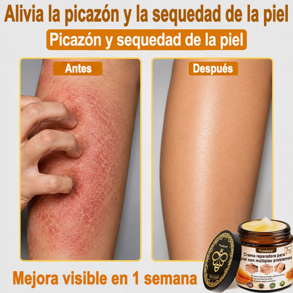 ✨🐝 Purelora® Crema de Reposición de Crema de Sol de Monocromo (Un solo producto para reposición) 𝐢𝐧𝐟𝐥𝐚𝐦𝐦𝐚𝐭𝐢𝐨𝐧, 𝐝𝐫𝐲𝐧𝐞𝐬𝐬, 𝐚𝐠𝐢𝐧𝐠, 𝐩𝐢𝐠𝐦𝐞𝐧𝐭𝐚𝐭𝐢𝐨𝐧, 𝐚𝐧𝐝 𝐯𝐢𝐬𝐢𝐛𝐥𝐞 𝐬𝐤𝐢𝐧 𝐝𝐚𝐦𝐚𝐠𝐞.)