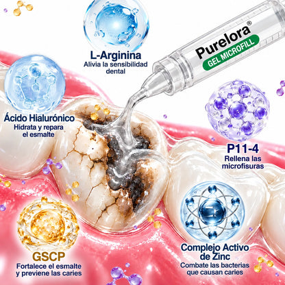 👨‍⚕️🦷✨𝐏𝐔𝐑𝐄𝐋𝐎𝐑𝐀® Gel MicroFill Pept11 Inverso de Cavidad