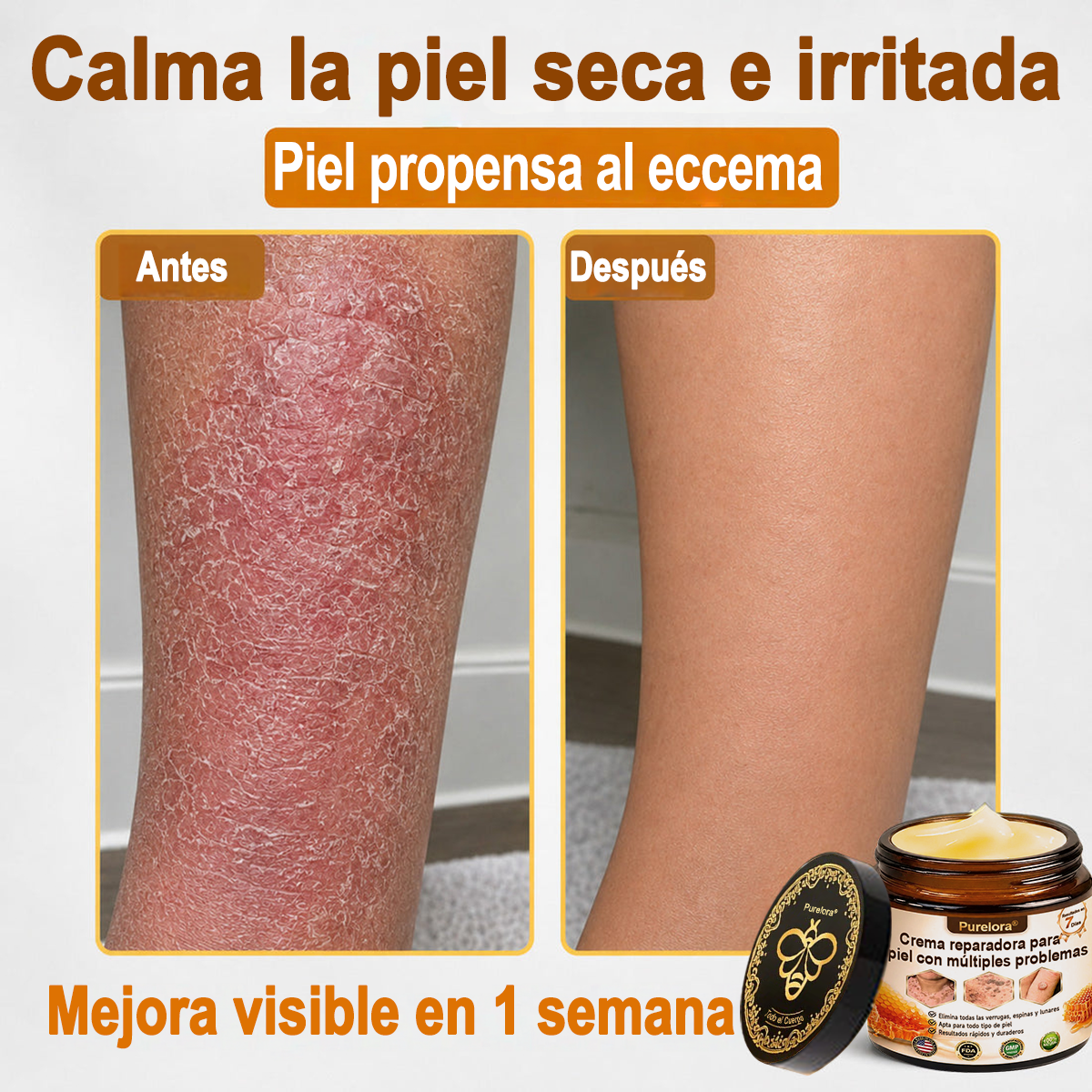 ✨🐝 Purelora® Crema de Reposición de Crema de Sol de Monocromo (Un solo producto para reposición) 𝐢𝐧𝐟𝐥𝐚𝐦𝐦𝐚𝐭𝐢𝐨𝐧, 𝐝𝐫𝐲𝐧𝐞𝐬𝐬, 𝐚𝐠𝐢𝐧𝐠, 𝐩𝐢𝐠𝐦𝐞𝐧𝐭𝐚𝐭𝐢𝐨𝐧, 𝐚𝐧𝐝 𝐯𝐢𝐬𝐢𝐛𝐥𝐞 𝐬𝐤𝐢𝐧 𝐝𝐚𝐦𝐚𝐠𝐞.)