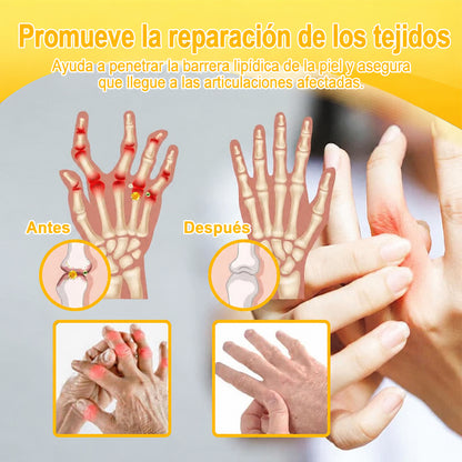 Crema Purelora® con toxina botulínica y veneno de abeja para el alivio del dolor y la regeneración ósea