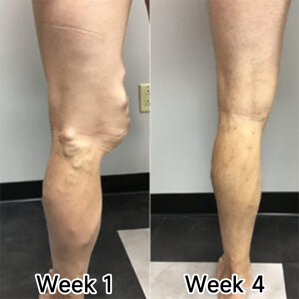 Purelora® RE:FORM Joint Comfort · Firming · Skin Resilience