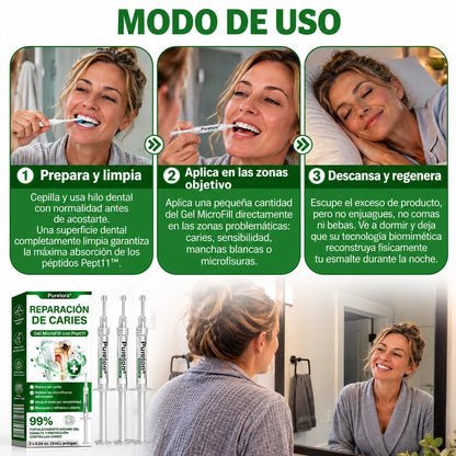 👨‍⚕️🦷✨𝐏𝐔𝐑𝐄𝐋𝐎𝐑𝐀® Gel MicroFill Pept11 Inverso de Cavidad