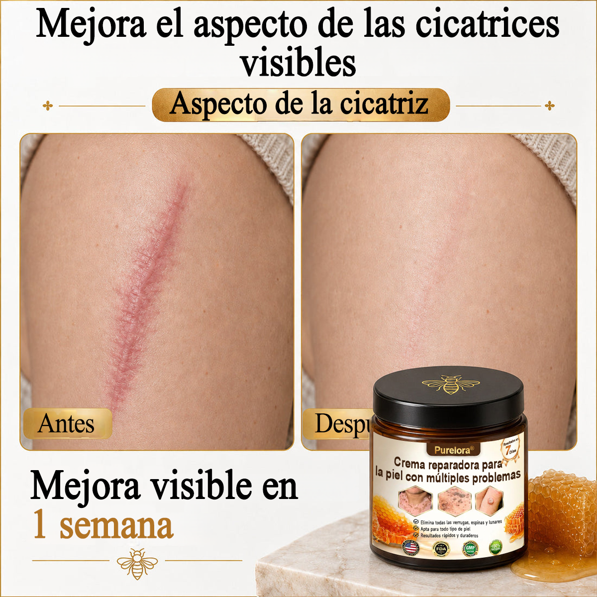 ✨🐝 Purelora® Crema de Reposición de Crema de Sol de Monocromo (Un solo producto para reposición) 𝐢𝐧𝐟𝐥𝐚𝐦𝐦𝐚𝐭𝐢𝐨𝐧, 𝐝𝐫𝐲𝐧𝐞𝐬𝐬, 𝐚𝐠𝐢𝐧𝐠, 𝐩𝐢𝐠𝐦𝐞𝐧𝐭𝐚𝐭𝐢𝐨𝐧, 𝐚𝐧𝐝 𝐯𝐢𝐬𝐢𝐛𝐥𝐞 𝐬𝐤𝐢𝐧 𝐝𝐚𝐦𝐚𝐠𝐞.)