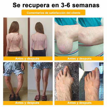 Crema Purelora® con toxina botulínica y veneno de abeja para el alivio del dolor y la regeneración ósea
