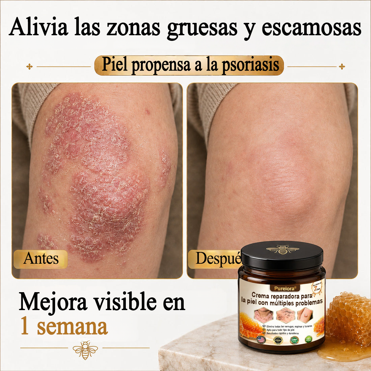 ✨🐝 Purelora® Crema de Reposición de Crema de Sol de Monocromo (Un solo producto para reposición) 𝐢𝐧𝐟𝐥𝐚𝐦𝐦𝐚𝐭𝐢𝐨𝐧, 𝐝𝐫𝐲𝐧𝐞𝐬𝐬, 𝐚𝐠𝐢𝐧𝐠, 𝐩𝐢𝐠𝐦𝐞𝐧𝐭𝐚𝐭𝐢𝐨𝐧, 𝐚𝐧𝐝 𝐯𝐢𝐬𝐢𝐛𝐥𝐞 𝐬𝐤𝐢𝐧 𝐝𝐚𝐦𝐚𝐠𝐞.)