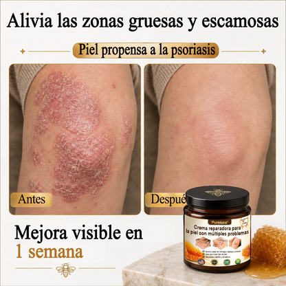 ✨🐝 Purelora® Crema de Reposición de Crema de Sol de Monocromo (Un solo producto para reposición) 𝐢𝐧𝐟𝐥𝐚𝐦𝐦𝐚𝐭𝐢𝐨𝐧, 𝐝𝐫𝐲𝐧𝐞𝐬𝐬, 𝐚𝐠𝐢𝐧𝐠, 𝐩𝐢𝐠𝐦𝐞𝐧𝐭𝐚𝐭𝐢𝐨𝐧, 𝐚𝐧𝐝 𝐯𝐢𝐬𝐢𝐛𝐥𝐞 𝐬𝐤𝐢𝐧 𝐝𝐚𝐦𝐚𝐠𝐞.)