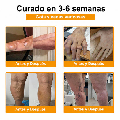 Crema Purelora® con toxina botulínica y veneno de abeja para el alivio del dolor y la regeneración ósea