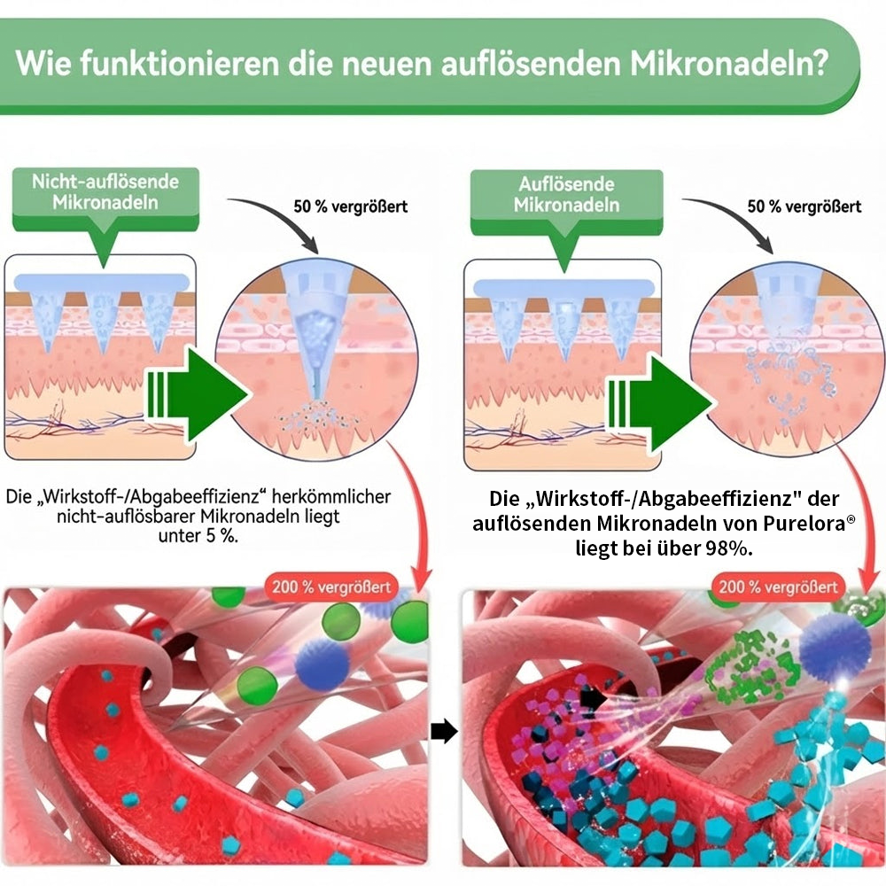 🇩🇪Neuheiten Heißer Verkauf丨Purelora® Moringa Berberinex NAD+ 10-in-1 Nano-Mikronadel-Patch (Nur einmal täglich, sichtbare Veränderungen in 7 Tagen) ✅ Für Übergewicht, lockere Haut, Diabetes, Schlafapnoe, Gelenkprobleme und mehr