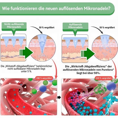 🇩🇪Neuheiten Heißer Verkauf丨Purelora® Moringa Berberinex NAD+ 10-in-1 Nano-Mikronadel-Patch (Nur einmal täglich, sichtbare Veränderungen in 7 Tagen) ✅ Für Übergewicht, lockere Haut, Diabetes, Schlafapnoe, Gelenkprobleme und mehr