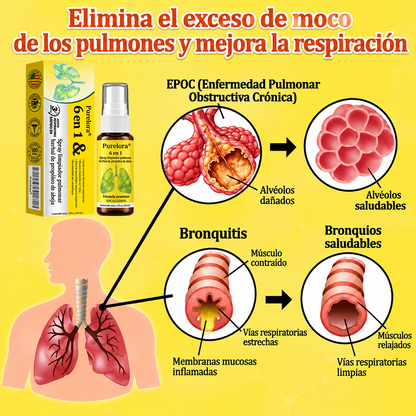 🍀🍀🐝🇺🇸Tienda oficial: 𝐏𝐔𝐑𝐄𝐋𝐎𝐑𝐀® Spray limpiador pulmonar de propóleo y abeja herbal 6 en 1 (👨‍⚕️Actúa directamente sobre la EPOC, el asma, la bronquitis crónica (BC), las infecciones respiratorias, el cáncer de pulmón, la sinusitis y otras afecciones🫁)