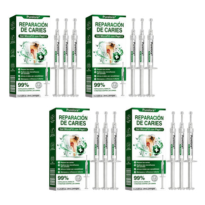 👨‍⚕️🦷✨𝐏𝐔𝐑𝐄𝐋𝐎𝐑𝐀® Gel MicroFill Pept11 Inverso de Cavidad