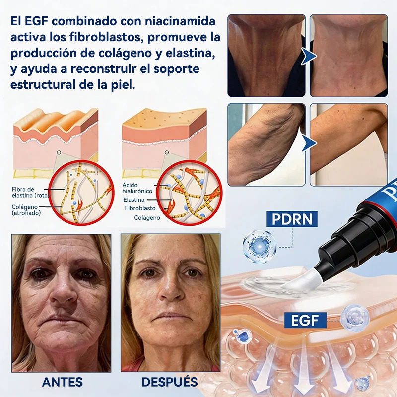 💎👨‍⚕️🌿𝐏𝐔𝐑𝐄𝐋𝐎𝐑𝐀® PDRN Anti-Wrinkle Shot – Crema reafirmante y con efecto lifting