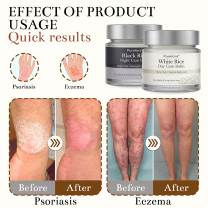 Purelora® Black and White Rice Day and Night Dual Repair Cream (Delays aging, repairs skin, removes warts, skin tags, and keratin buildup, providing 24-hour care for your skin)