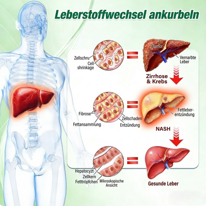 🇩🇪Neuheiten Heißer Verkauf丨Purelora® Moringa Berberinex NAD+ 10-in-1 Nano-Mikronadel-Patch (Nur einmal täglich, sichtbare Veränderungen in 7 Tagen) ✅ Für Übergewicht, lockere Haut, Diabetes, Schlafapnoe, Gelenkprobleme und mehr