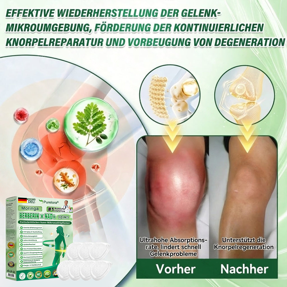 🇩🇪Neuheiten Heißer Verkauf丨Purelora® Moringa Berberinex NAD+ 10-in-1 Nano-Mikronadel-Patch (Nur einmal täglich, sichtbare Veränderungen in 7 Tagen) ✅ Für Übergewicht, lockere Haut, Diabetes, Schlafapnoe, Gelenkprobleme und mehr