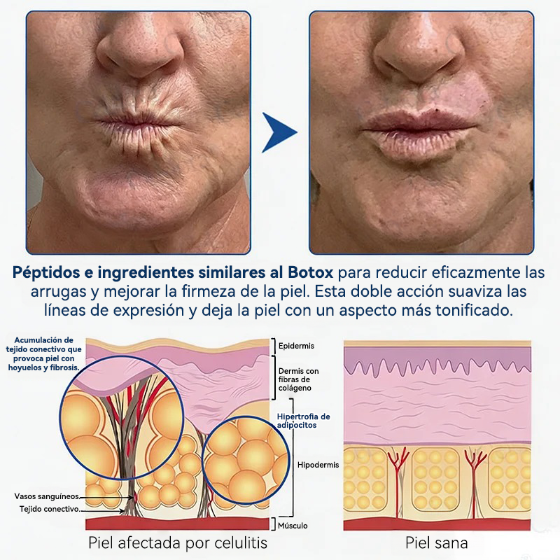 💎👨‍⚕️🌿𝐏𝐔𝐑𝐄𝐋𝐎𝐑𝐀® PDRN Anti-Wrinkle Shot – Crema reafirmante y con efecto lifting