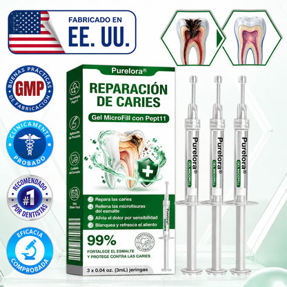 👨‍⚕️🦷✨𝐏𝐔𝐑𝐄𝐋𝐎𝐑𝐀® Gel MicroFill Pept11 Inverso de Cavidad