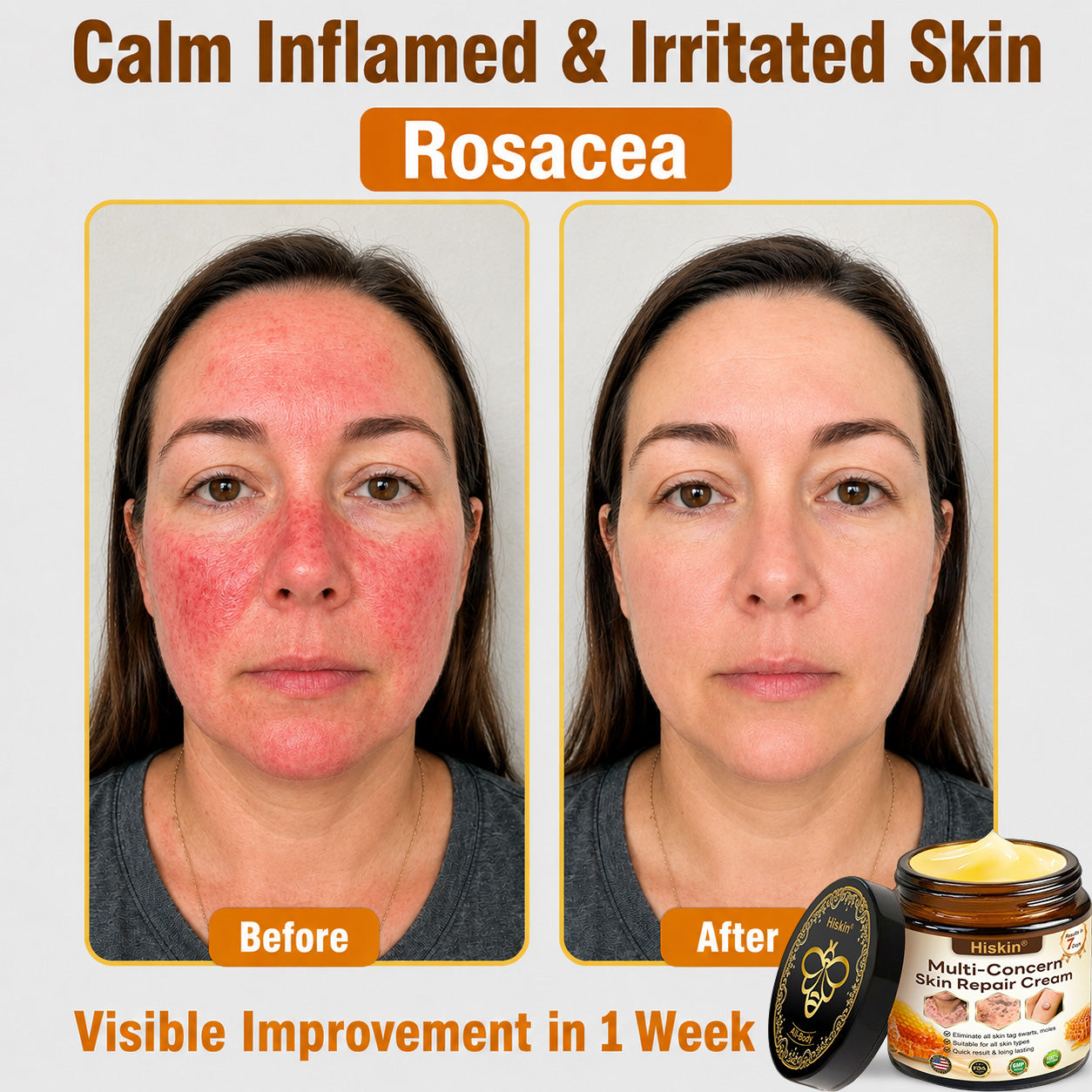 ✨🐝𝐇𝐈𝐒𝐊𝐈𝐍® 𝐌𝐮𝐥𝐭𝐢-𝐂𝐨𝐧𝐜𝐞𝐫𝐧 𝐒𝐤𝐢𝐧 𝐑𝐞𝐩𝐚𝐢𝐫 𝐂𝐫𝐞𝐚𝐦 (𝐎𝐧𝐞 𝐩𝐨𝐰𝐞𝐫𝐟𝐮𝐥 𝐜𝐫𝐞𝐚𝐦 𝐭𝐨 𝐫𝐞𝐩𝐚𝐢𝐫 𝐢𝐧𝐟𝐥𝐚𝐦𝐦𝐚𝐭𝐢𝐨𝐧, 𝐝𝐫𝐲𝐧𝐞𝐬𝐬, 𝐚𝐠𝐢𝐧𝐠, 𝐩𝐢𝐠𝐦𝐞𝐧𝐭𝐚𝐭𝐢𝐨𝐧, 𝐚𝐧𝐝 𝐯𝐢𝐬𝐢𝐛𝐥𝐞 𝐬𝐤𝐢𝐧 𝐝𝐚𝐦𝐚𝐠𝐞.)