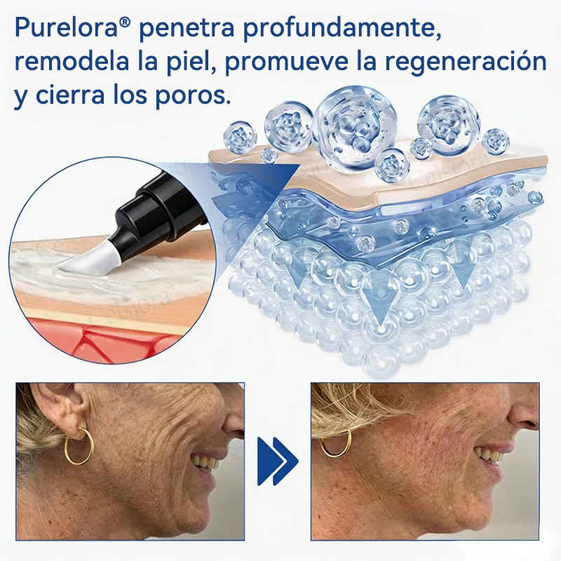 💎👨‍⚕️🌿𝐏𝐔𝐑𝐄𝐋𝐎𝐑𝐀® PDRN Anti-Wrinkle Shot – Crema reafirmante y con efecto lifting