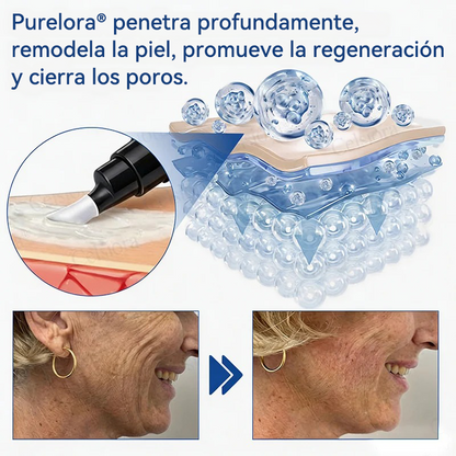 💎👨‍⚕️🌿𝐏𝐔𝐑𝐄𝐋𝐎𝐑𝐀® PDRN Anti-Wrinkle Shot – Crema reafirmante y con efecto lifting