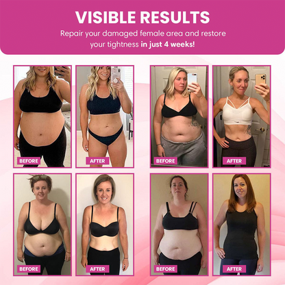 📢Curalona® Instant Itching Stopper & Detox and Slimming & Firming Repair & Pink and Tender Natural Capsules PRO