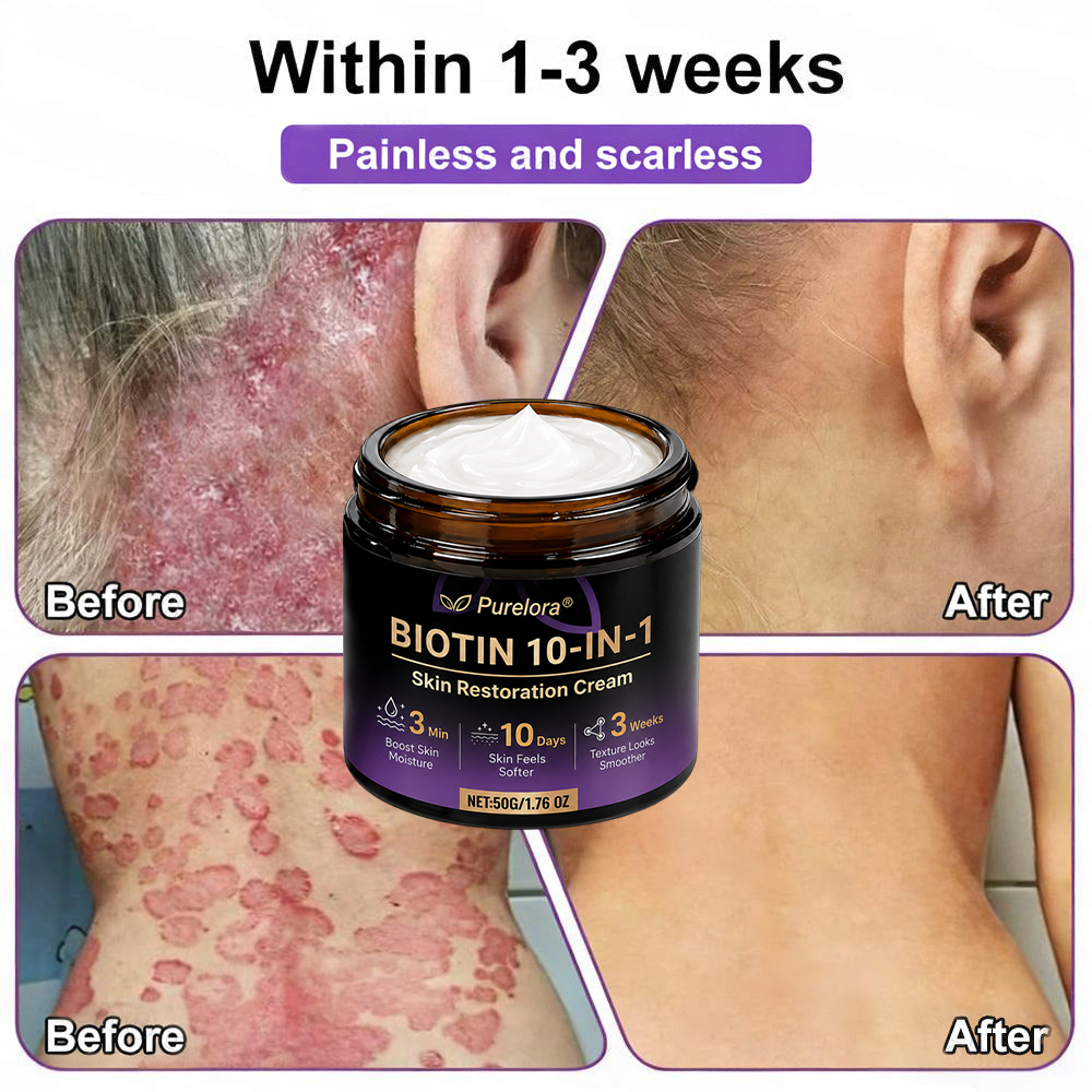 Fabricada y enviada desde EE. UU. 🍁 Crema reparadora de la piel Purelora® con biotina (fórmula 10 en 1) — Último día de oferta: 75 % de descuento.（副本）