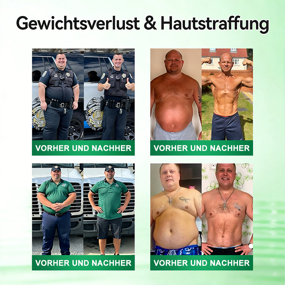 Curalona® Advanced Slim Patch – 10-in-1 Berberin- & NAD⁺-basierte zelluläre Stoffwechselunterstützung für eine natürliche Gewichtskontrolle (7-Tage-Programm)