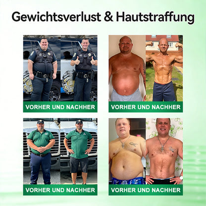Curalona® Advanced Slim Patch – 10-in-1 Berberin- & NAD⁺-basierte zelluläre Stoffwechselunterstützung für eine natürliche Gewichtskontrolle (7-Tage-Programm)
