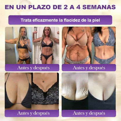 Fabricada y enviada desde EE. UU. 🍁 Crema reparadora de la piel Purelora® con biotina (fórmula 10 en 1) — Último día de oferta: 75 % de descuento.