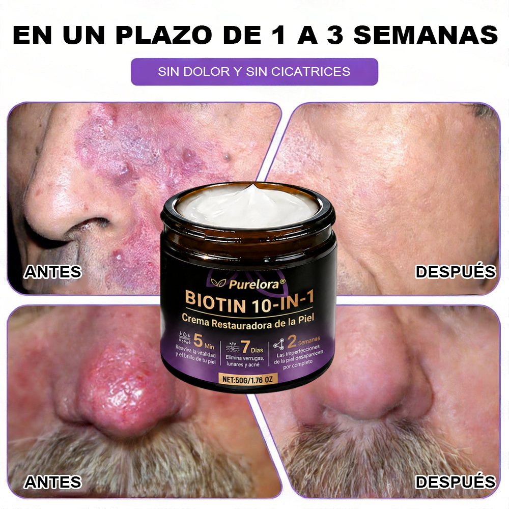 Fabricada y enviada desde EE. UU. 🍁 Crema reparadora de la piel Purelora® con biotina (fórmula 10 en 1) — Último día de oferta: 75 % de descuento.
