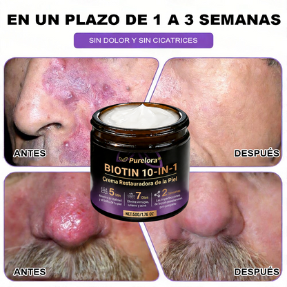 Fabricada y enviada desde EE. UU. 🍁 Crema reparadora de la piel Purelora® con biotina (fórmula 10 en 1) — Último día de oferta: 75 % de descuento.