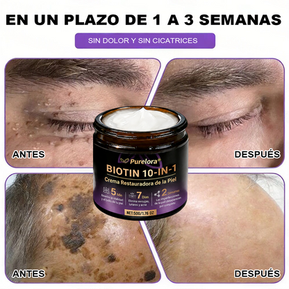 Fabricada y enviada desde EE. UU. 🍁 Crema reparadora de la piel Purelora® con biotina (fórmula 10 en 1) — Último día de oferta: 75 % de descuento.
