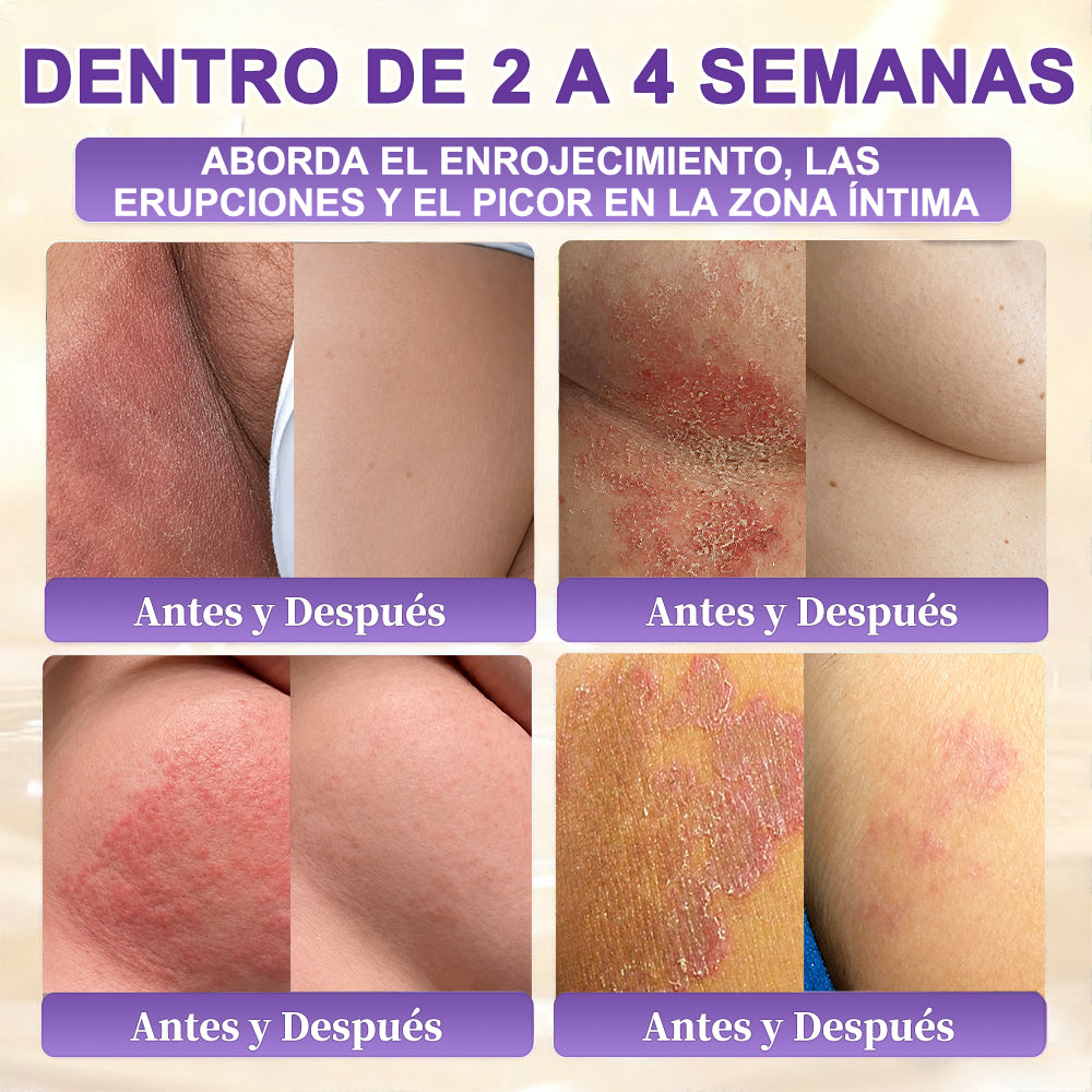 PURELORA® Yoni & Wart Relief Bar Soap | pH-Balanced with Boric Acid & Tea Tree Oil | 2-in-1 Intimate Care & Skin Clarifying Bar | Women's Daily Wash