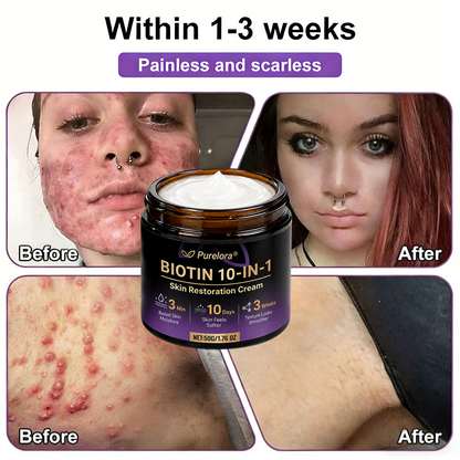 Fabricada y enviada desde EE. UU. 🍁 Crema reparadora de la piel Purelora® con biotina (fórmula 10 en 1) — Último día de oferta: 75 % de descuento.（副本）